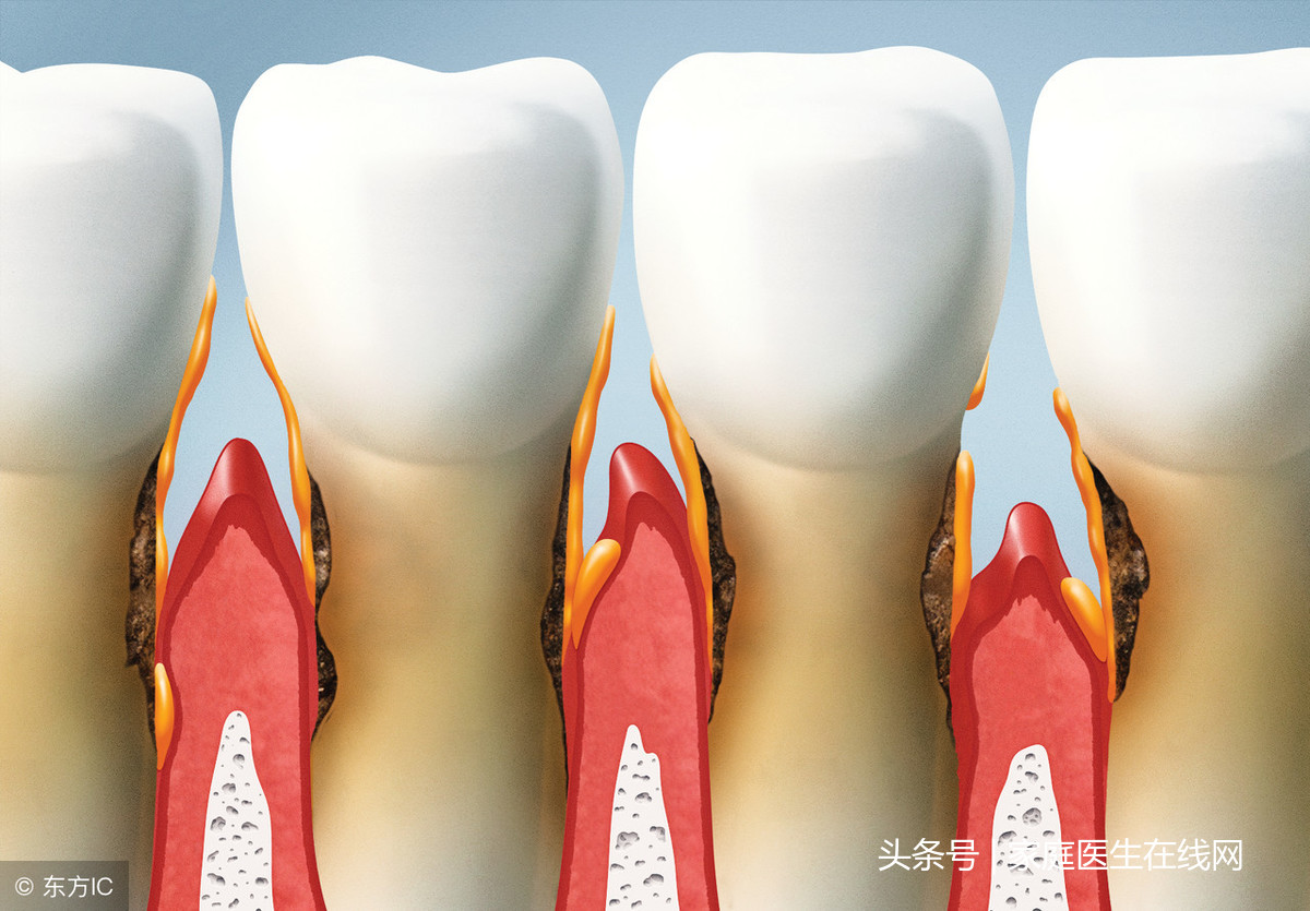 牙龈萎缩是不治之症吗？医生无奈：只能靠这些方法缓解